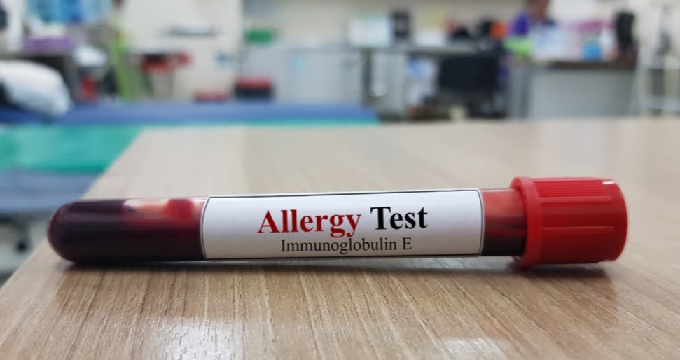 Allergy Profile